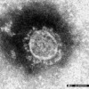 国立感染症研究所で分離された新型コロナウイルスの電子顕微鏡写真=同研究所提供